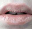 16 домашних способов вылечить треснутые губы за 5 минут