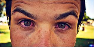 23 натуральных способа предотвращения покраснения глаз от курения