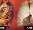 12 способов очищения лёгких после продолжительного курения
