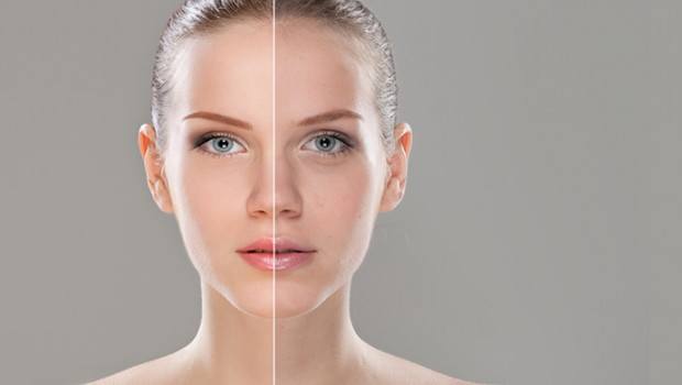 13 здоровых способов восстановить тусклую кожу у женщин