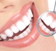 11 преимуществ хорошей гигиены зубов и полости рта