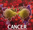 7 факторов образа жизни, ведущих к раку (нужно избегать!)