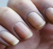29 естественных способов лечения желтых ногтей дома