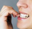 Влияние кусания ногтей на здоровье полости рта.