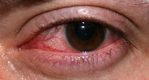 8 безопасных способов очистки ваших чувствительных глаз
