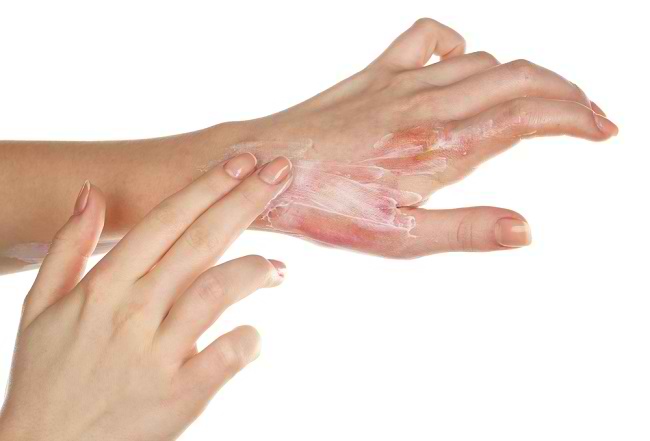 4 предупреждающих признака злокачественных опухолей рук