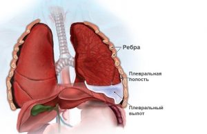 fluid in lungs