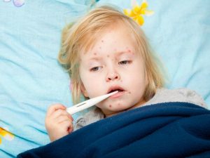 measles in children