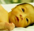14 общих симптомов желтухи у младенцев