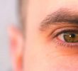 Глазная гипертензия (симптомы, причины, лечение)
