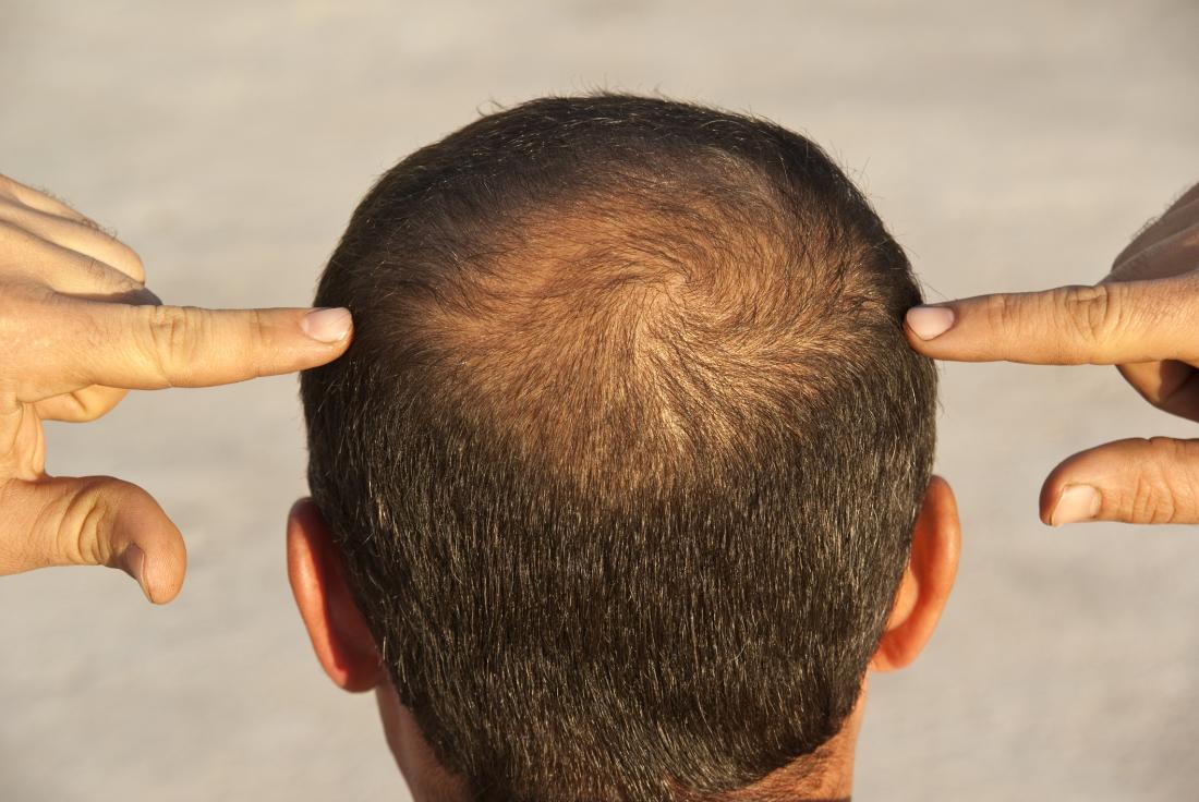Почему волосы сухие только на одной стороне головы